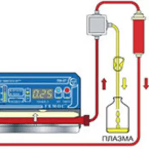 Проведение сеансов аппаратного фильтрационного плазмафереза