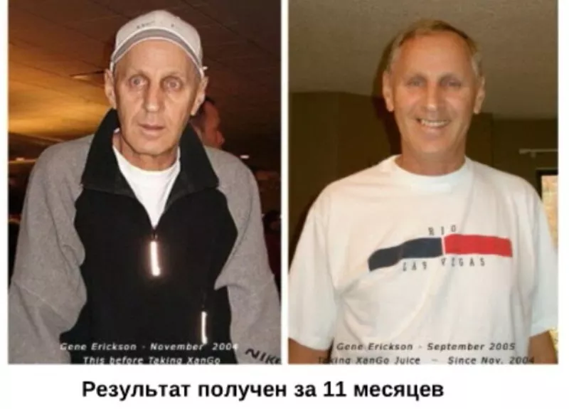 Оздоровление на клеточном уровне. Сок Ксанго из мангустина 