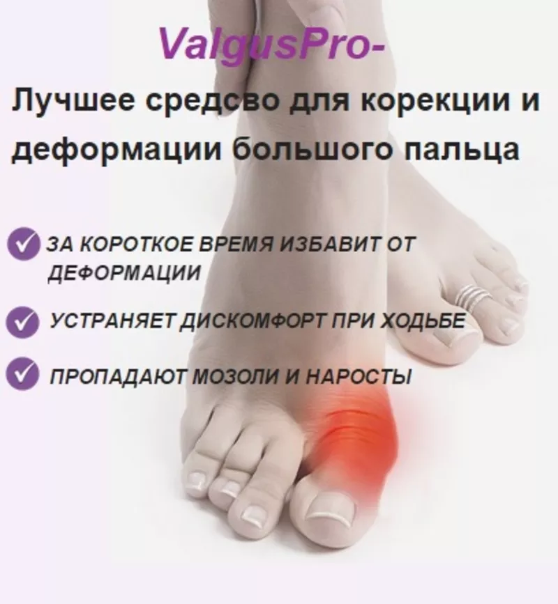 Супер цена!!! Успейте купить Valgus Pro!!! 