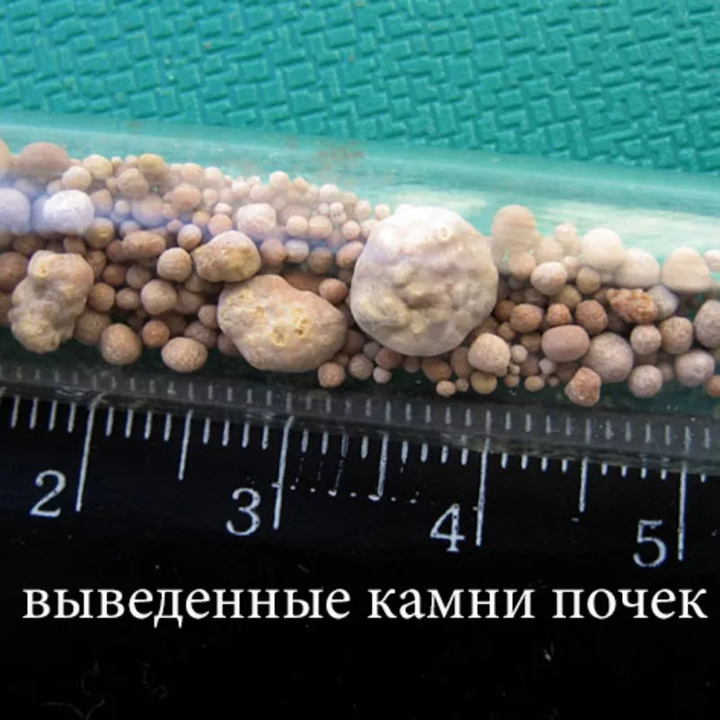 Лечение травами. Врач-терапевт Щербина С.В. Лицензия МОЗ 283488 3